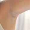 男性腋臭如何保健