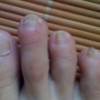灰指甲的产生原因有什么