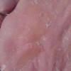 治疗脚气好的是哪