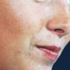 预防雀斑你注意要点了吗