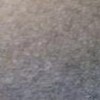 表皮松解性角化过度鱼鳞病的发病特点