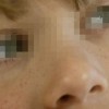 经过食疗帮你淡化雀斑