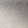 常见毛周角化症的医治的方法