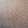 带你认识毛周角化