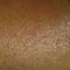 引发皮肤异痒常常看见的因素