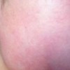 引发全身性皮肤瘙痒症的可能病因