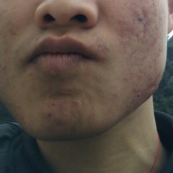 病例/检查单/图片