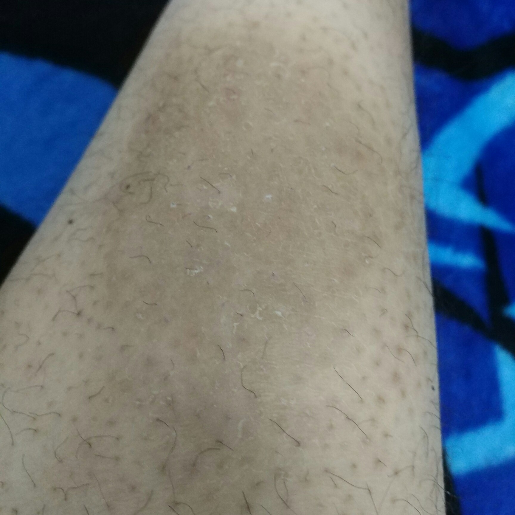 病例/检查单/图片