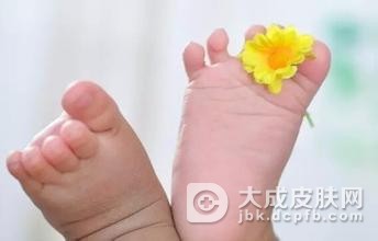 中医治疗角化型脚气的方法