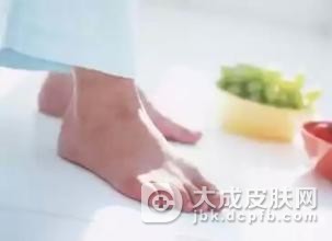 什么是角化型脚气