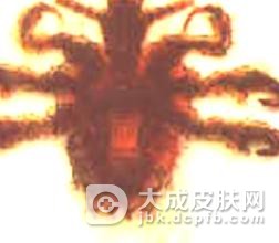 虱病是如何发生的?有何特点?