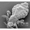 虱病的预防措施都有哪些?