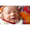 婴儿湿疹该如何护理
