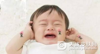 儿童虫咬性皮炎有什么临床症状?