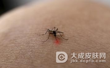 虫咬性皮炎不要搔抓