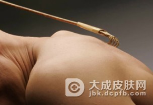 皮肤瘙痒饮食注意事项有什么