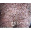 阴虱病有效的治疗的手法是什么呢