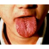 皱襞舌的主要特点是什么