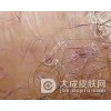 面部毛囊炎要注意什么