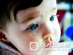 为什么会出现成人水痘呢
