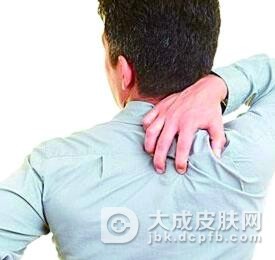 皮肌炎是否能够治愈