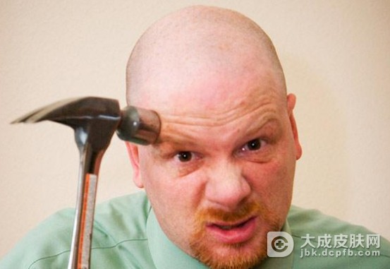 治疗脂溢性脱发大概需要多少钱