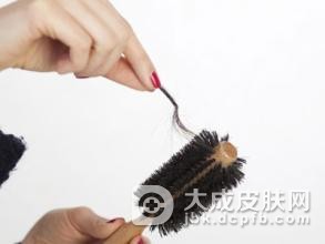 头癣发病的原因主要是哪些