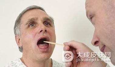 治疗慢性咽炎用润喉糖 不靠谱