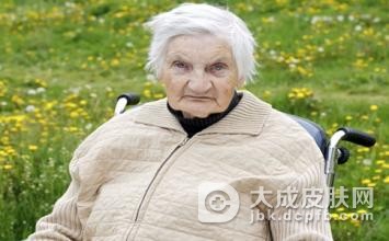 治疗“老年斑”全攻略
