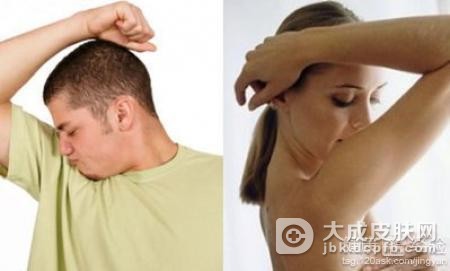 得了多汗症要怎么治疗