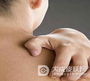 皮肤瘙痒症有效的治疗好呢?