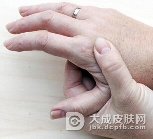 老年人皮肤瘙痒症的护理