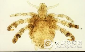 阴虱病是怎么得上的