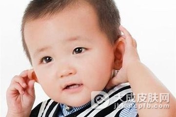 婴儿患上耳朵湿疹怎么办