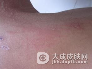 冬季易出现瘙痒的部分