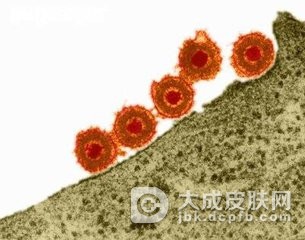 关于单纯疱疹病毒感染症的知识