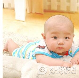 如何治疗新生儿生理性黄疸