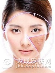 激素依赖性皮炎该怎么办？