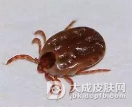 立氏立克次体斑疹热早期症状
