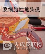 如何确诊为包皮龟头炎