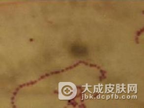 细菌协同性坏疽容易与哪些疾病混淆