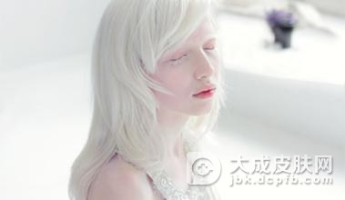 白化病的根本原因