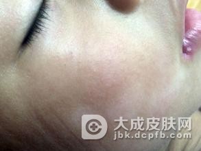 多发性硬化症科学的诊断方法