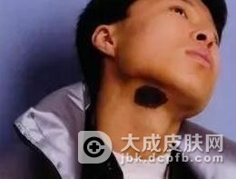 鳞状细胞癌如何正确进行饮食调理