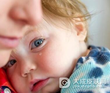 小儿半乳糖血症检查诊断
