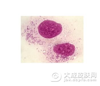 如何护理地方性斑疹伤寒