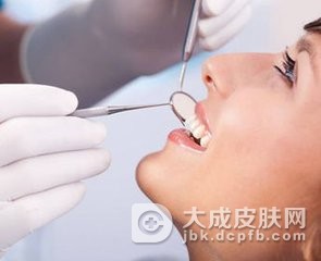 口腔粘膜白斑应如何护理