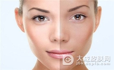 皮肤黑变病的中医理论是什么