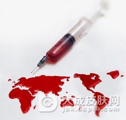 艾滋病有哪些表现及如何诊断？