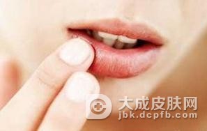 引起口腔粘膜白斑的两大类因素是什么